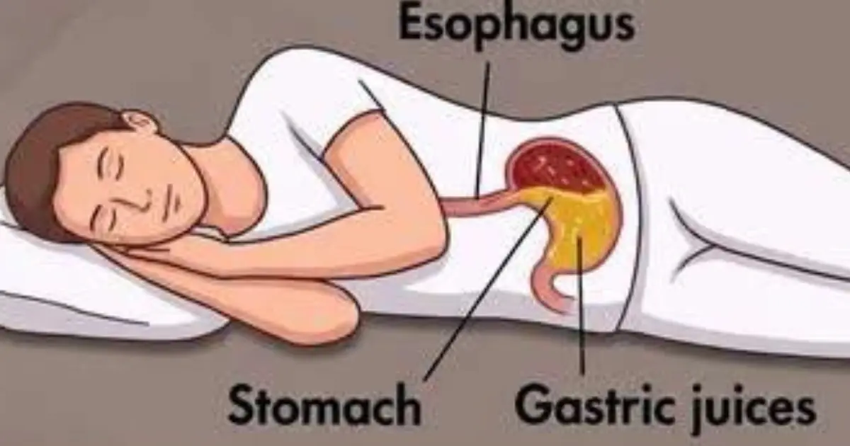 Why Sleeping on Your Left Side May Be Better for Your Health