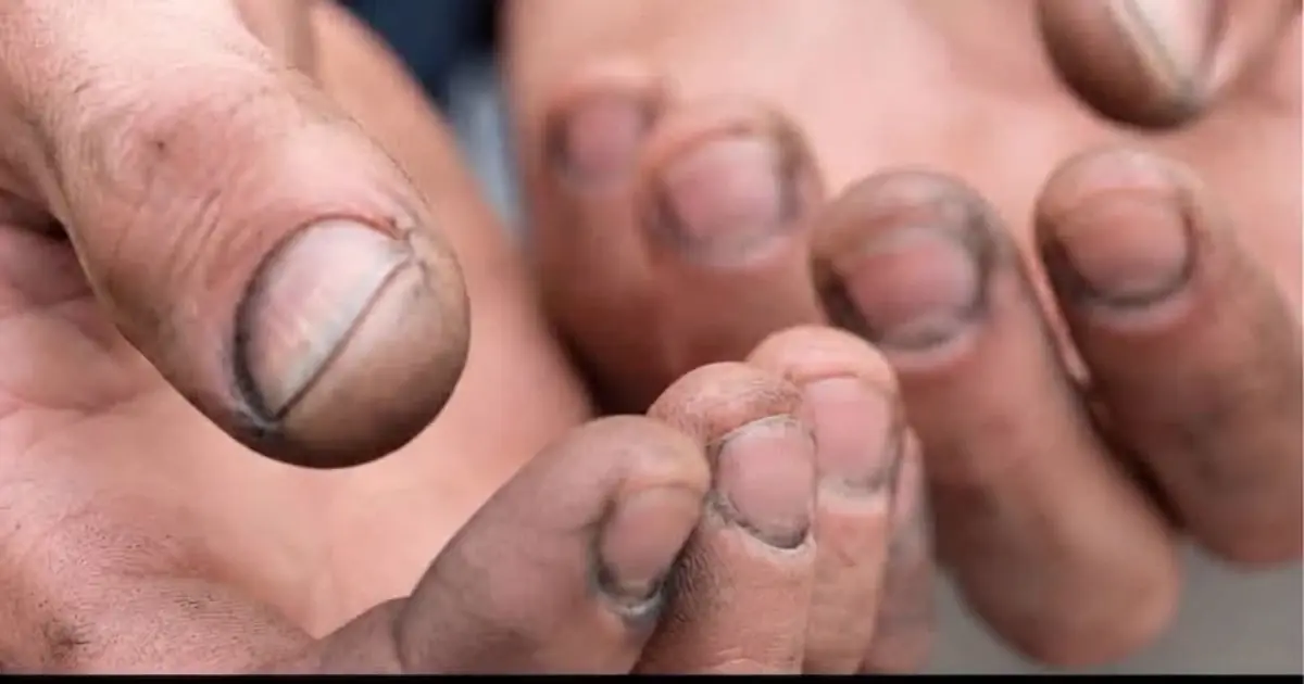 What do you call a person with nails like that?