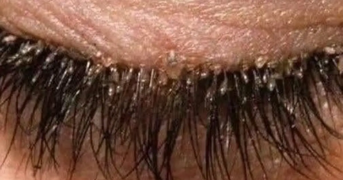 Here are the consequences of sleeping with… See more