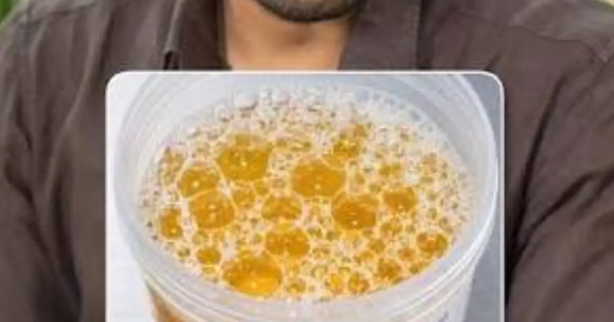 Bubbles in Your Urine? It Could Be Nothing — or It Could Be a Sign Worth Checking