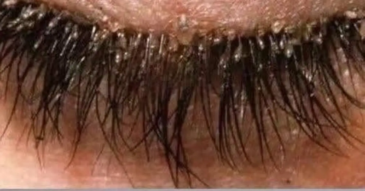 Here are the consequences of sleeping with… See more
