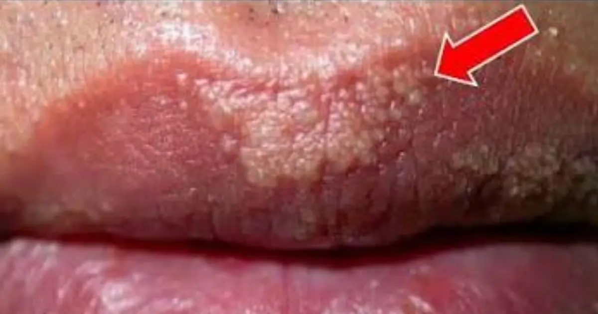 White Patches or Spots on Your Skin? These Changes May Be Worth Taking a Closer Look At