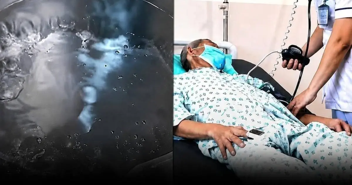 Think your kettle is safe? Number 2 shocks everyone