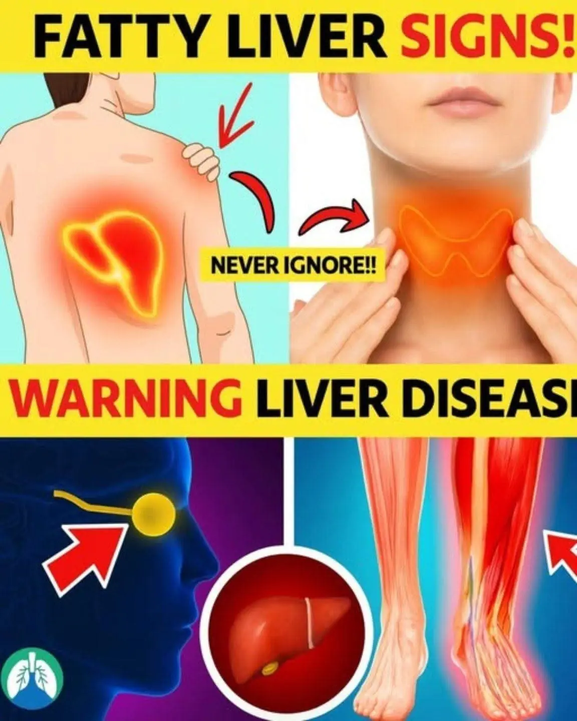 Early Symptoms That May Point to Fatty Liver Problems