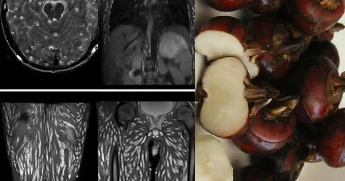 Eating Just One Bite is Already Harmful, But Many Still Eat It Without Worry