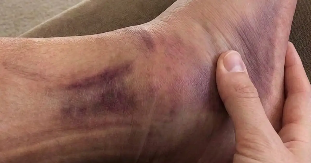 You Wear This Every Day—But Do You Know What It Could Be Doing to Your Body?