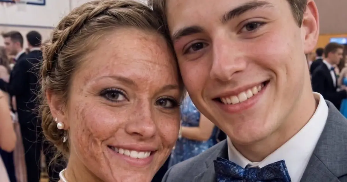 One Prom Photo, One Powerful Message: How a Young Woman Inspired Thousands With Her Confidence