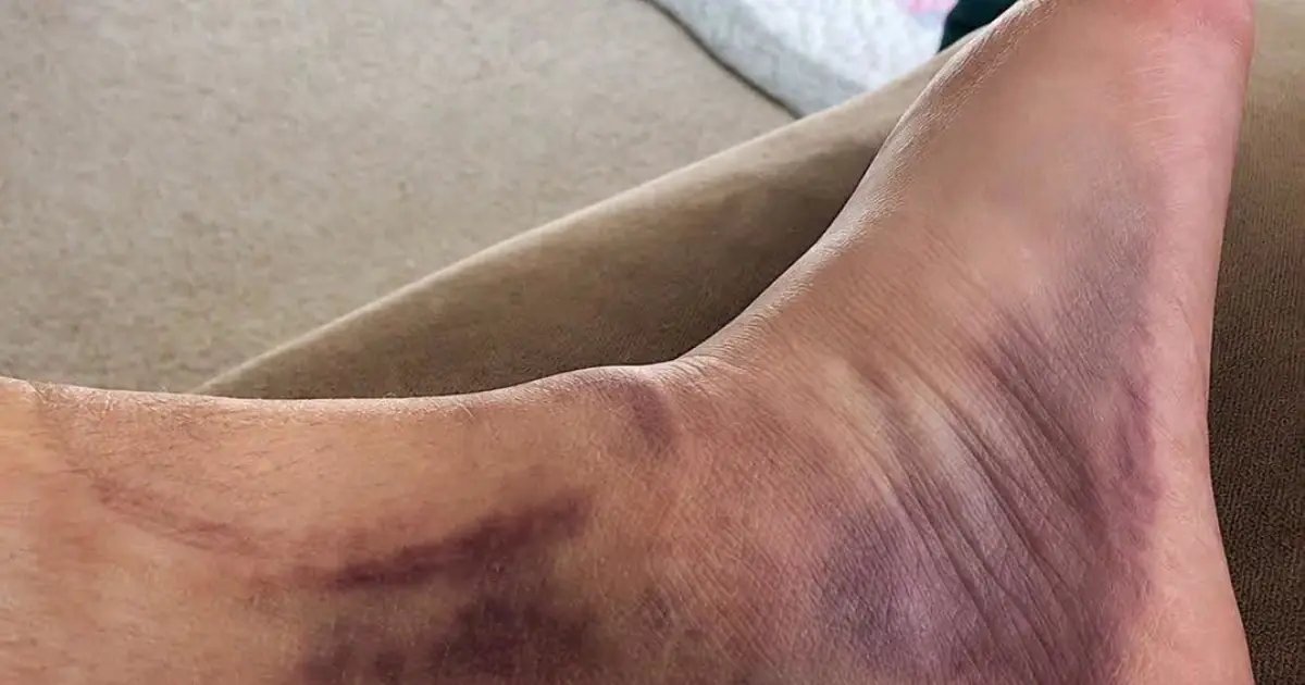 These are the consequences of wearing… See more