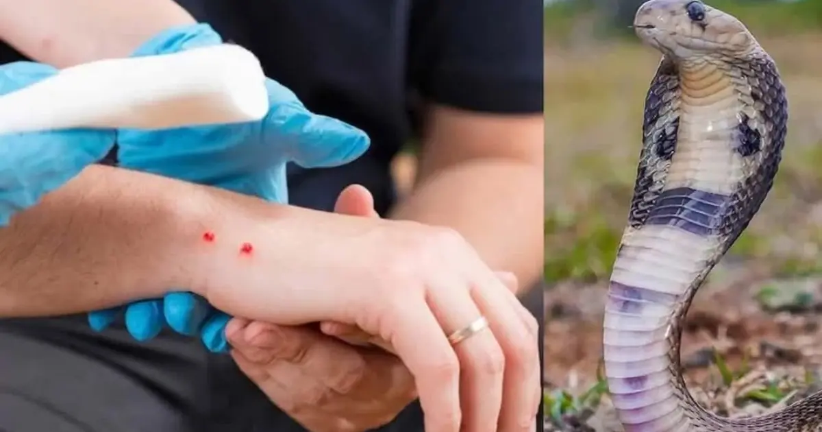 What To Do Immediately After a Snake Bite: First Aid That Could Save a Life