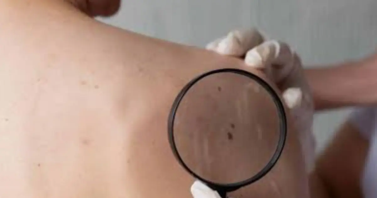 Your Body May Give You Clues Before Cancer Is Diagnosed — Here Are 5 Signs to Watch For