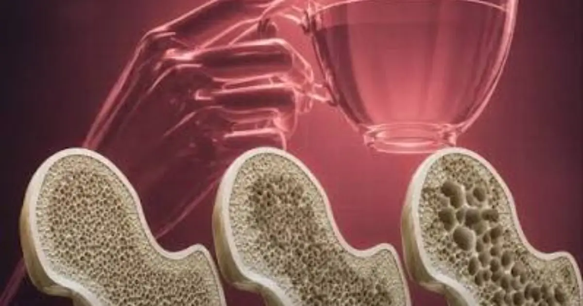 Think Your Favorite Drinks Are Harmless? Here Are 5 You May Want to Limit for Better Bone Health
