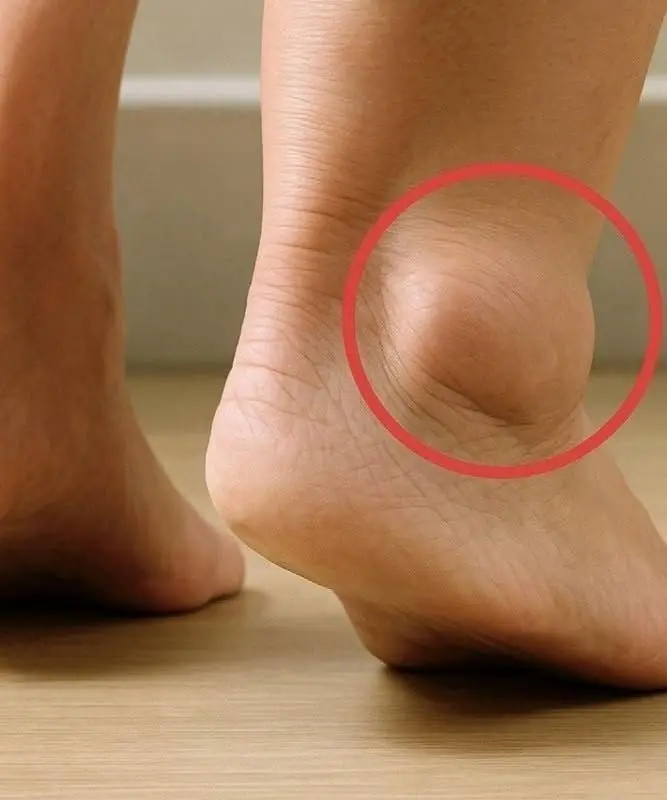 If you notice your legs are swollen, that’s a sign of ca…See more