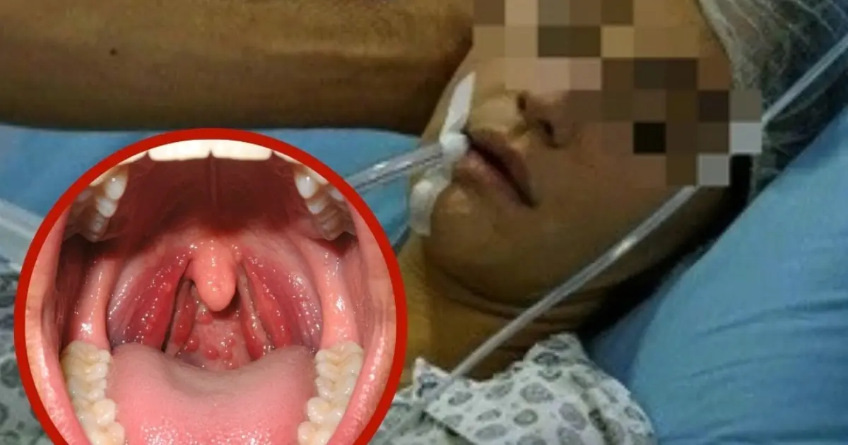 She Thought It Was Just A Sore Throat. Five Days Later, She Was D.ead