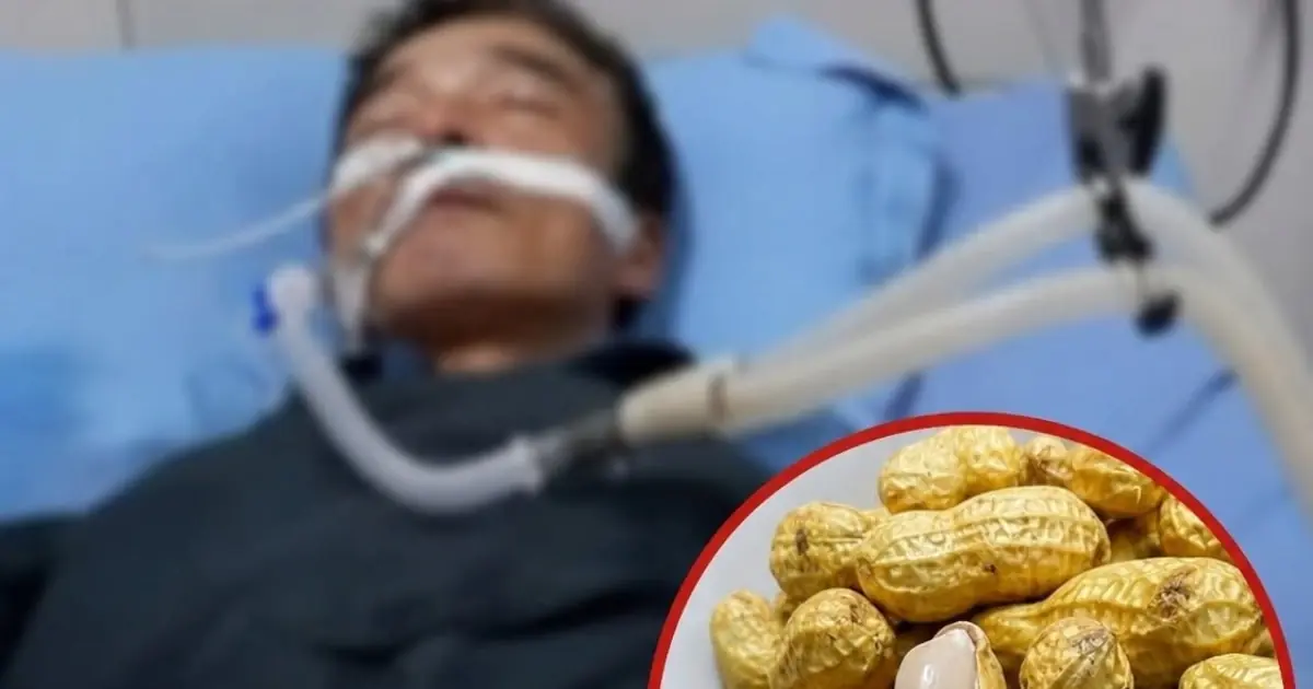 Peanuts Aren’t Just a Snack - Doctors Warn They May Lead to…