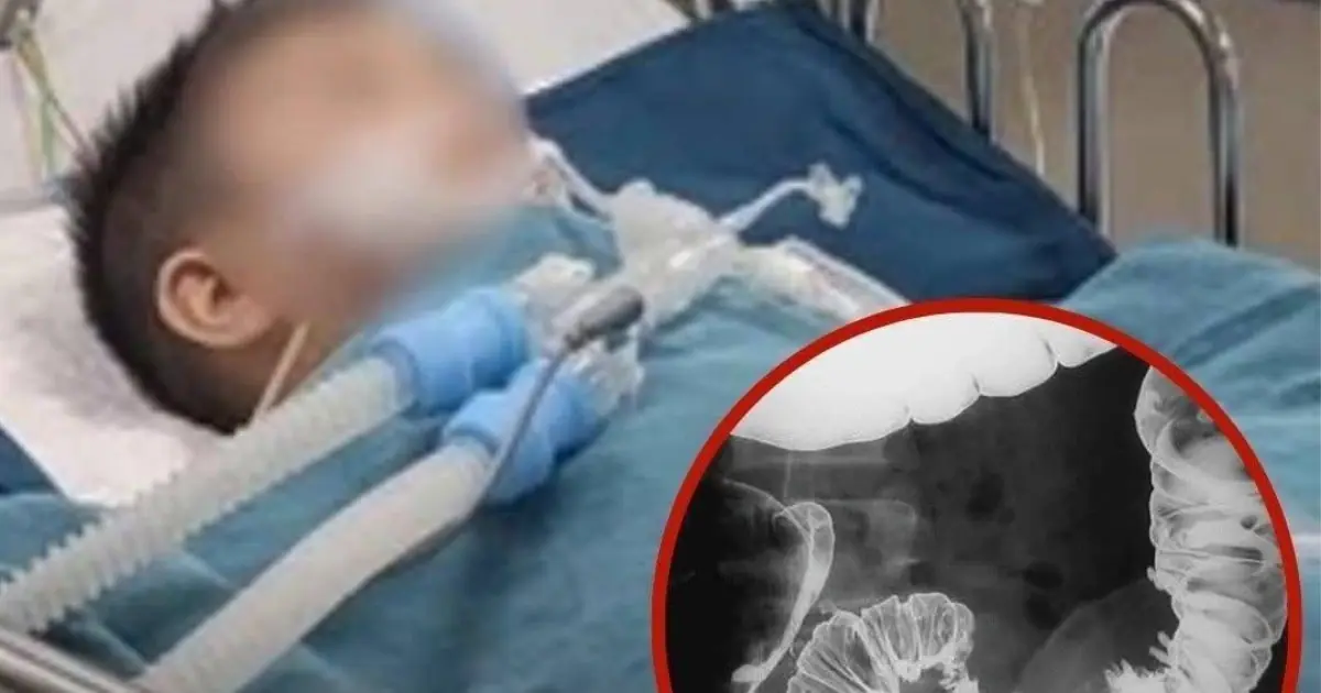 Second-Grader Diagnosed with Colon C.anc.er After Regularly Eating These 2 Foods Since Childhood