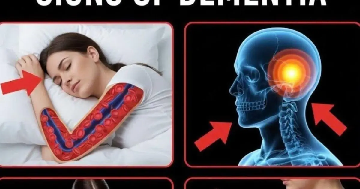 10 Early Signs of Dementia You Should NEVER Ignore!