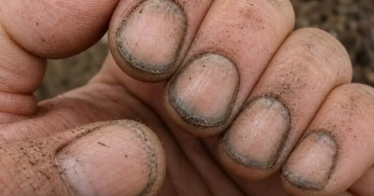 What Do Filthy Fingernails Really Reveal About a Person?