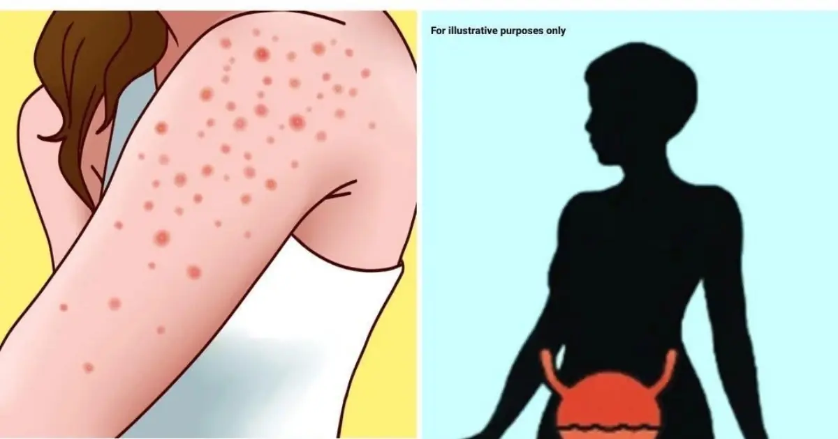 11 Silent Signs Your Body May Show Before Diabetes Develops