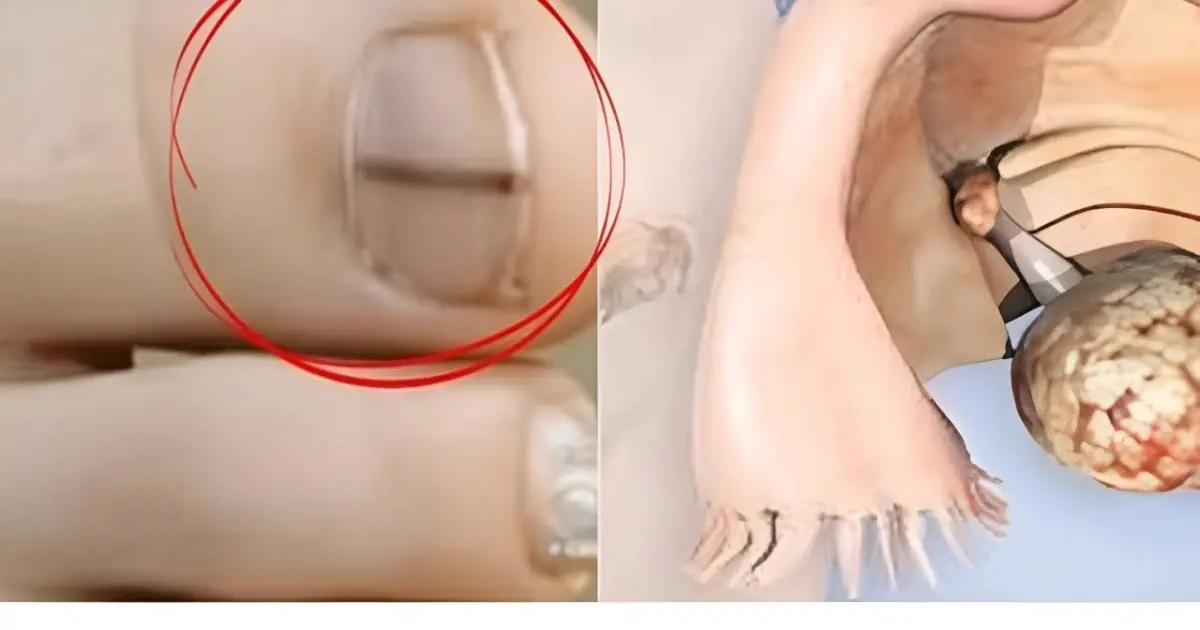 20 Warning Signs of Cancer Women Should Never Ignore