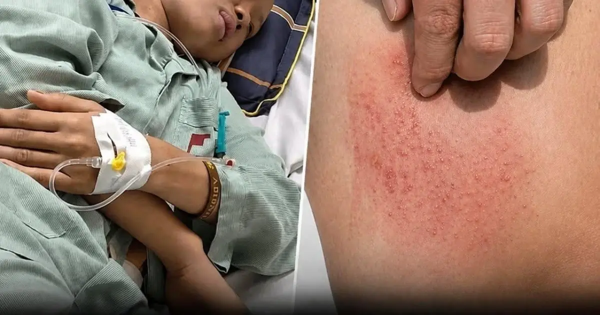 Watch for 2 Unusual Odors, 2 Types of Itching, and 2 Early Warning Signs.