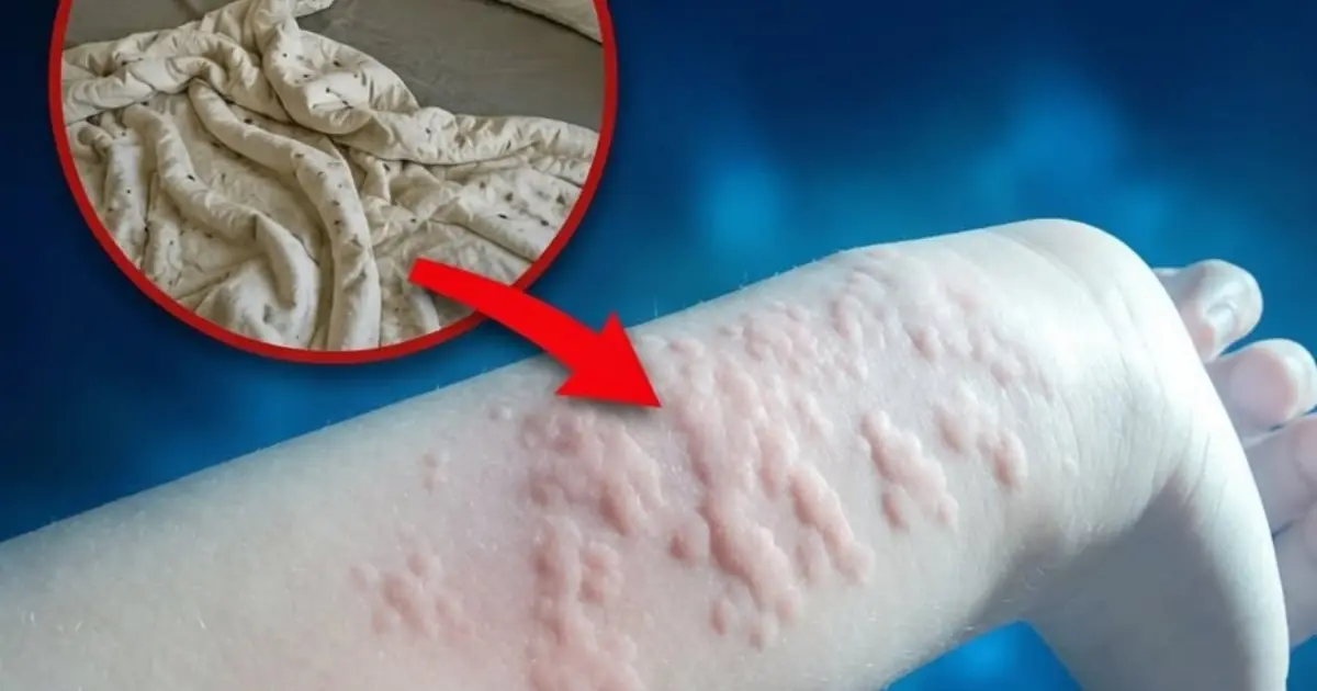 These are the consequences of sleeping with a... See more