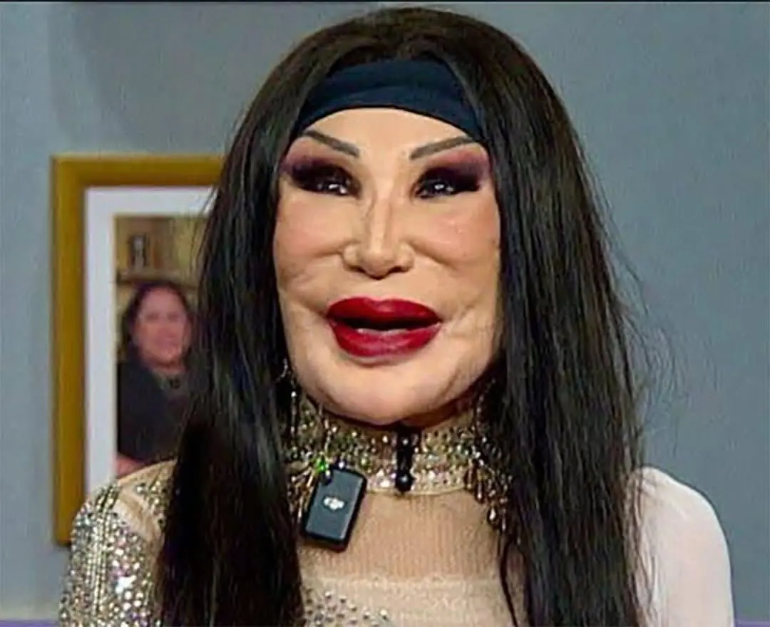She Starred in 100 Films, But a Tragic Mistake Completely Ruined Her Looks