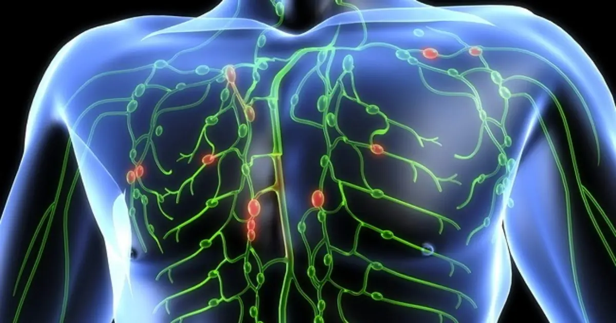 How Can.cer Can Spread Through the Lymphatic System - What Experts Want You to Know