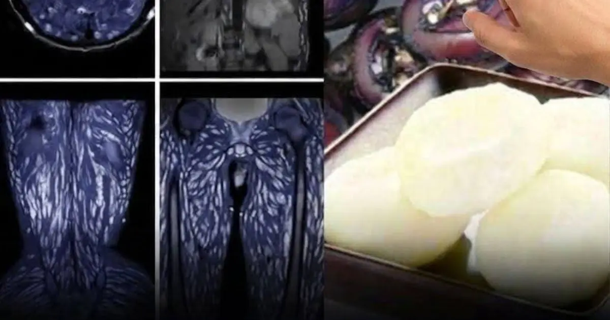 The Truth About Parasites in Food: Separating Facts From Viral Claims
