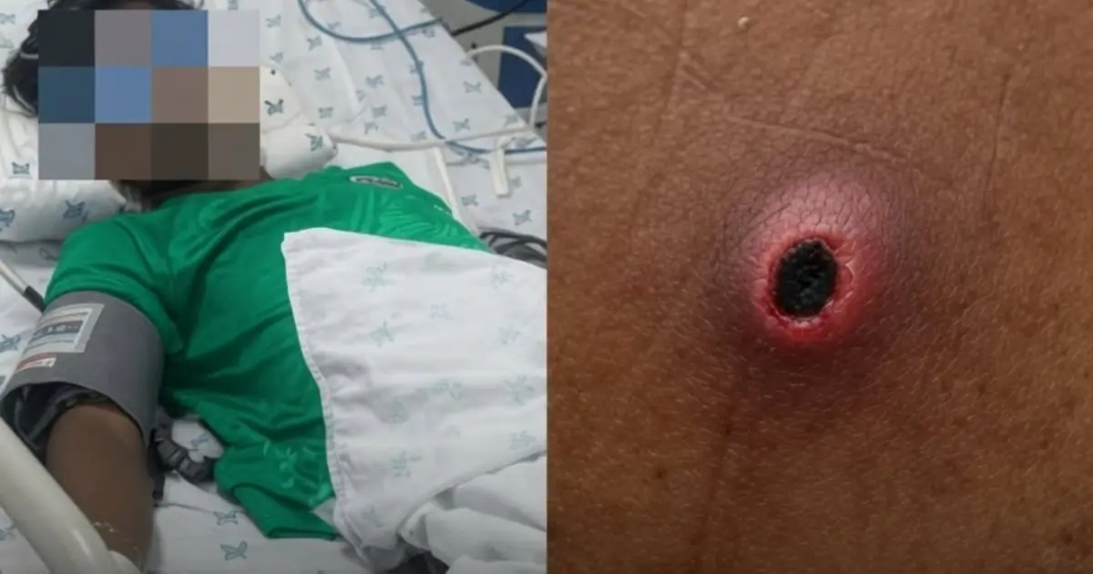 Doctor Lifted His Pant Leg, Then Ordered an Emergency ICU Transfer.