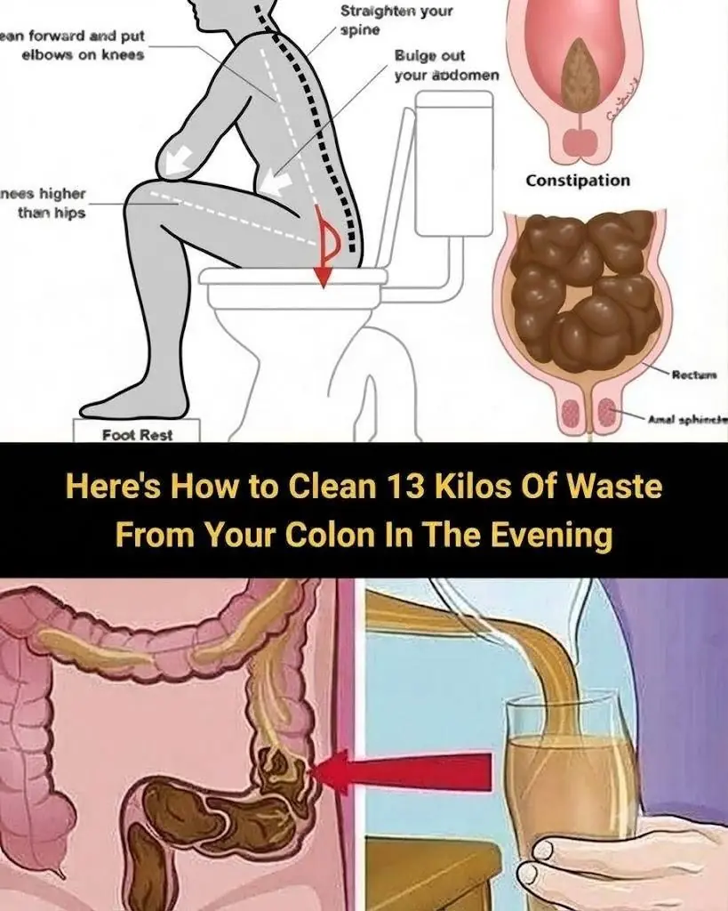 Thinking About an Overnight Colon Cleanse? Here’s What You Should Know...