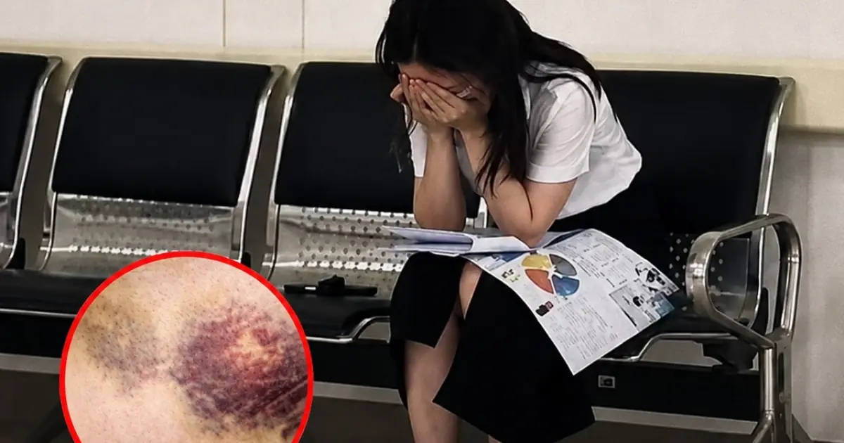 Young Woman Diagnosed With Leukemia at 23: The Warning Signs She Almost Missed
