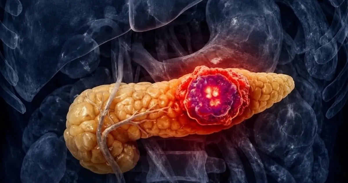 These Subtle Symptoms Could Be Early Warning Signs of Pancreatic Can.cer—Don’t Ignore Them