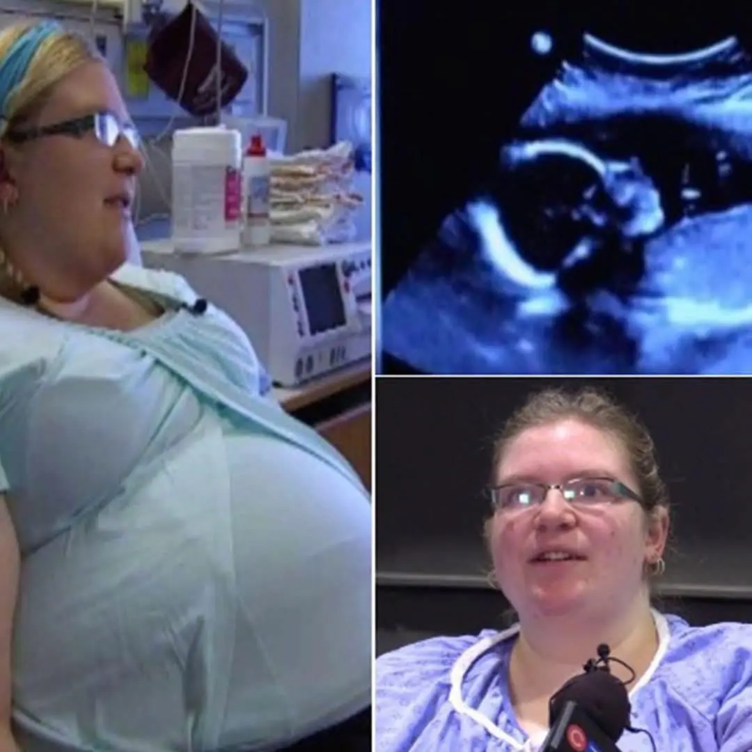 Couple Stunned by 1-in-15-Million Discovery During Ultrasound
