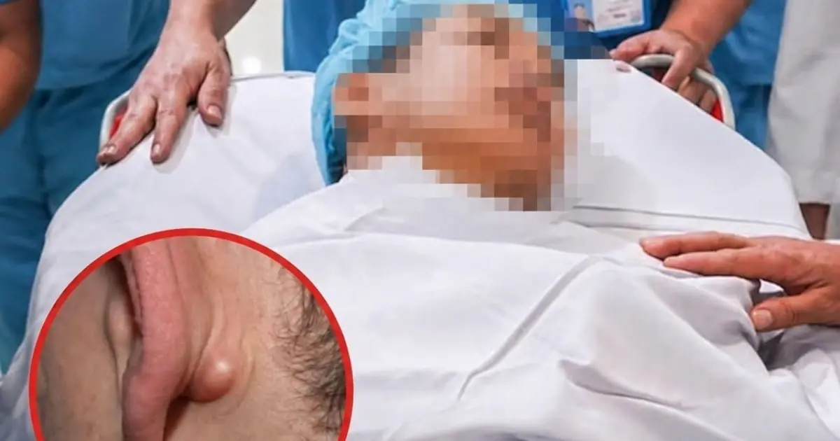 Young Man in His 20s D.i.es of C.anc.er After Ignoring Two Nighttime Symptoms