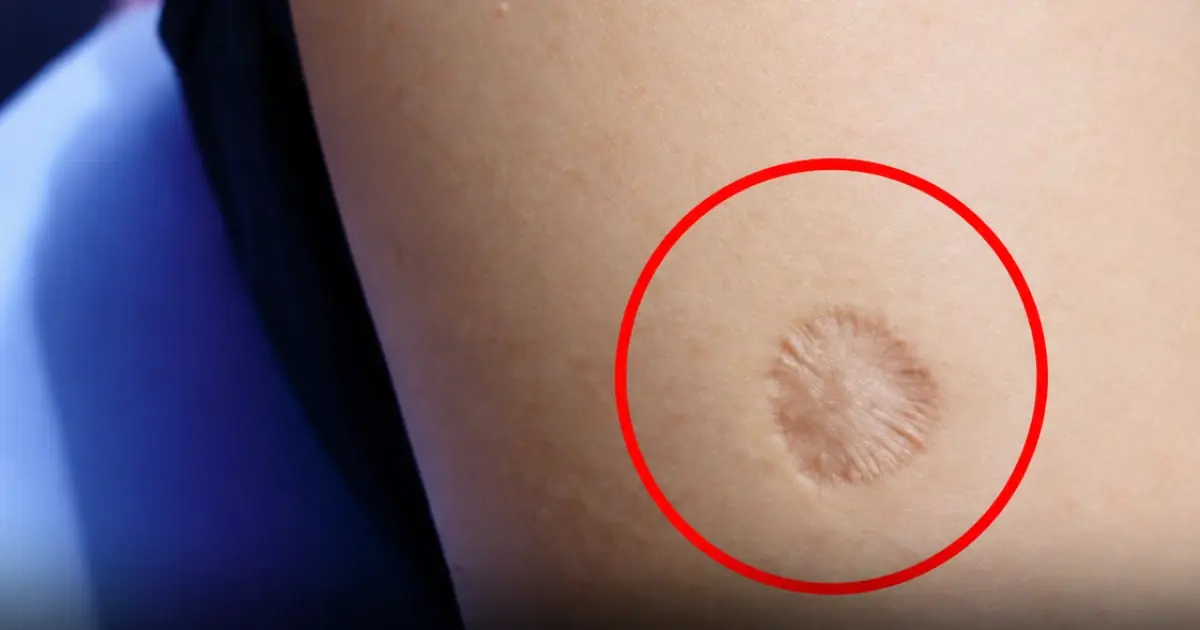 A Tiny Mark With a World-Changing History