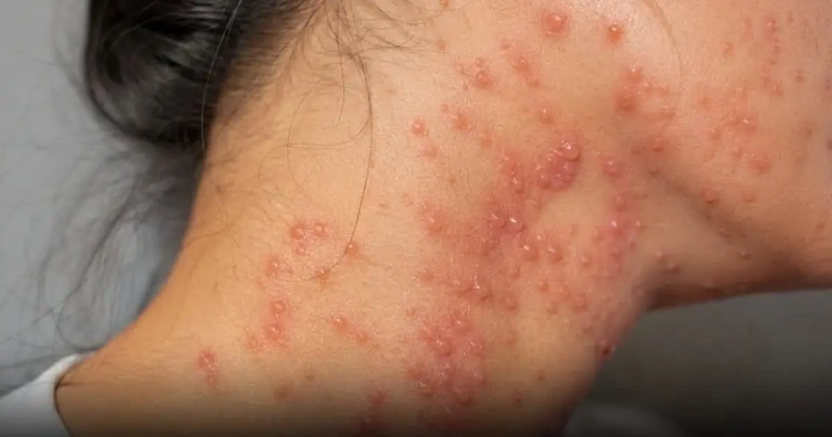 Sleeping With an Unwashed Face? Here’s What It Could Do to Your Skin