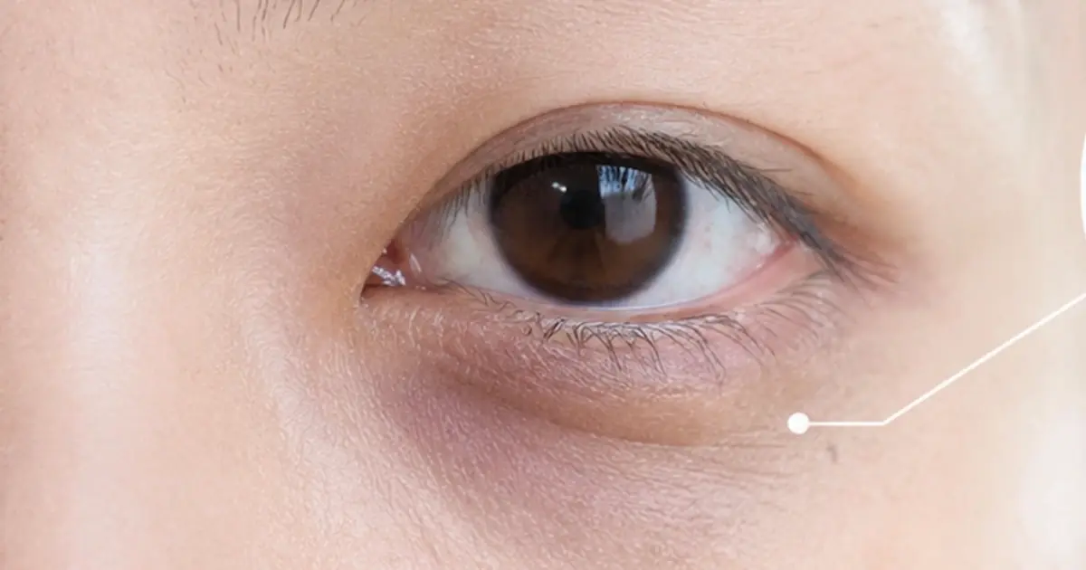 Puffy Eyes and Dark Circles in the Morning? This 10-Minute Routine May Help