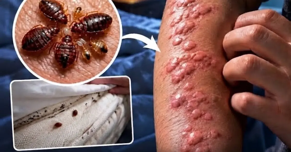 The Hidden Consequences of Sleeping with Bed Bugs Without Realizing It