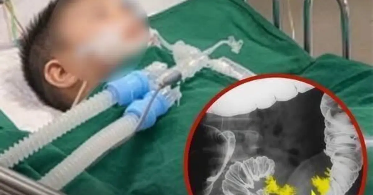 A Child’s Colon Cancer Diagnosis Sparks Discussion About Diet and Long-Term Health