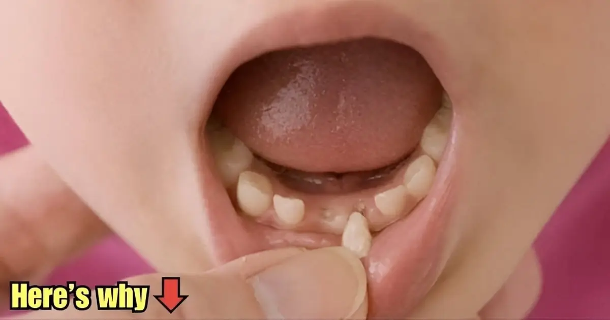 Why More Parents Are Saving Their Children’s Baby Teeth — And What Science Says About It