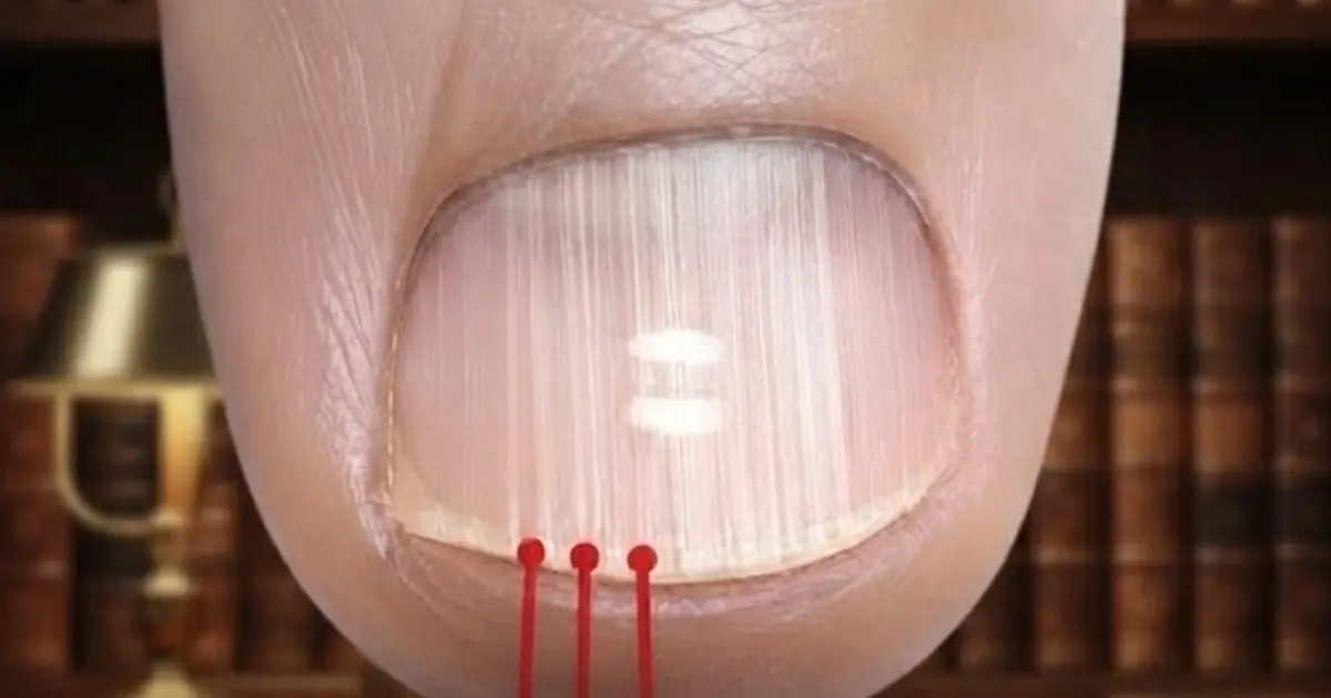 Nail Lines After 40? Doctors Explain What These Changes May Be Linked To