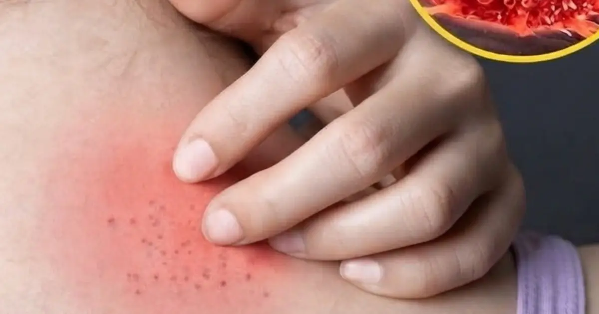 Experiencing Unusual Itching? These 9 Signs May Be Trying to Tell You Something