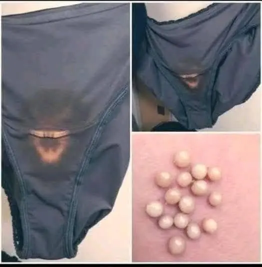 These Stains on Underwear May Reveal More Than You Think