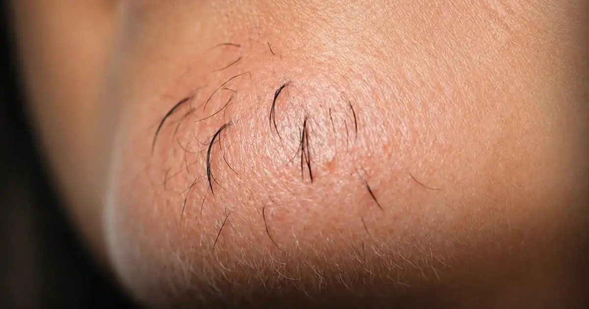 A woman’s chin hair is a sign of…See more