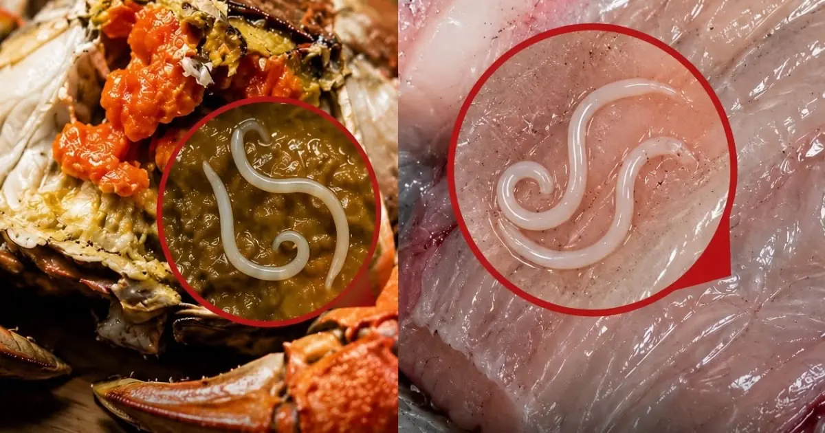 Doctors Warn: These 4 Popular Foods May Hide Dangerous Parasites