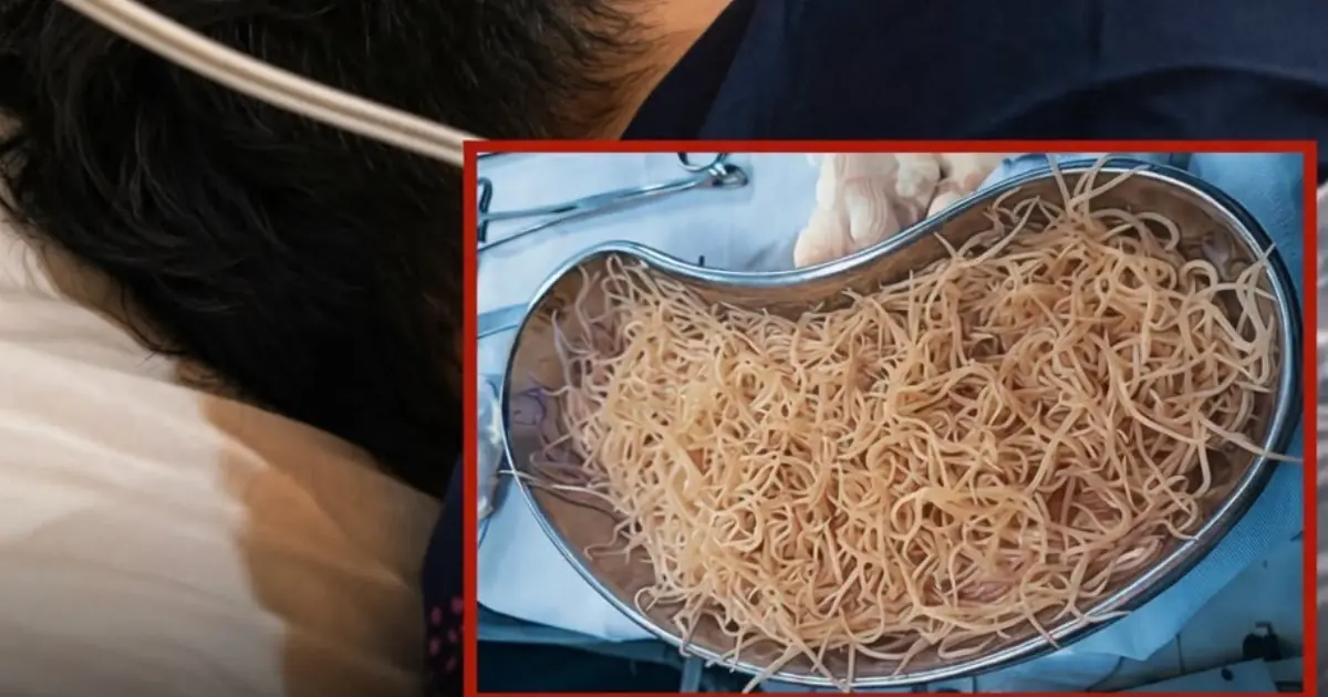 Doctors Were Sho.cked By What They Found Inside His Intestines…
