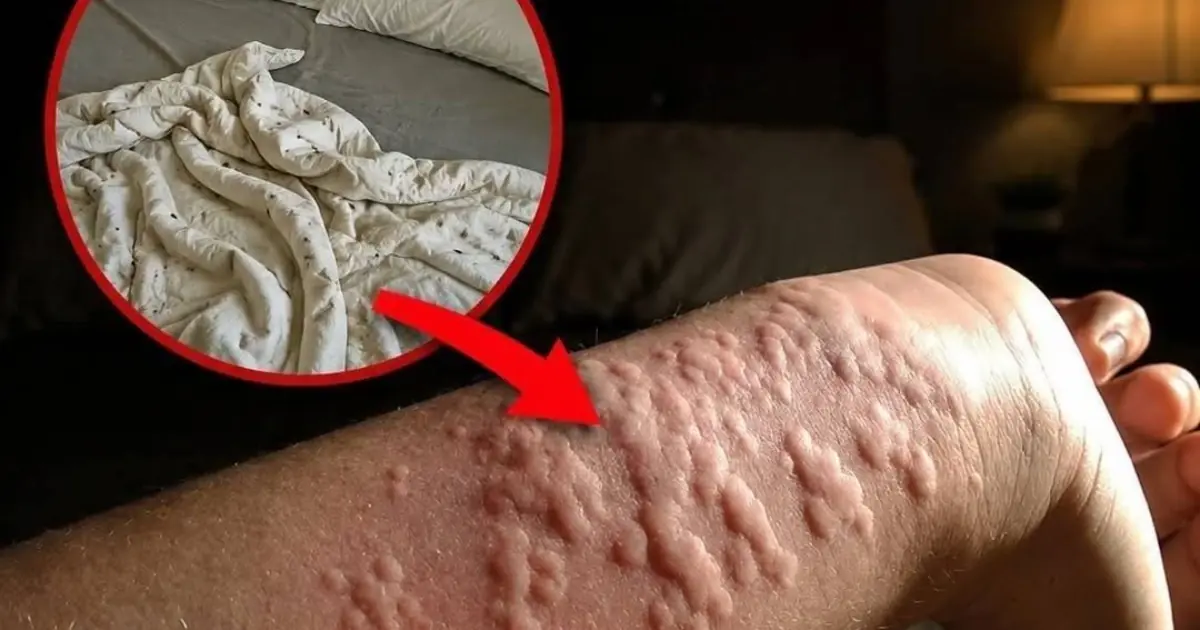 Bed Bugs in Your Bed? The Warning Signs You Should Never Ignore