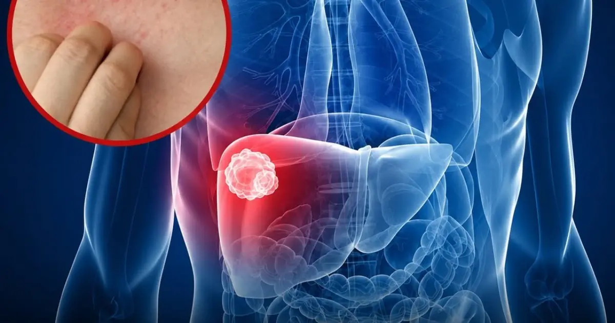Doctors Say Persistent Right Shoulder Pain Could Mean More Than a Muscle Strain