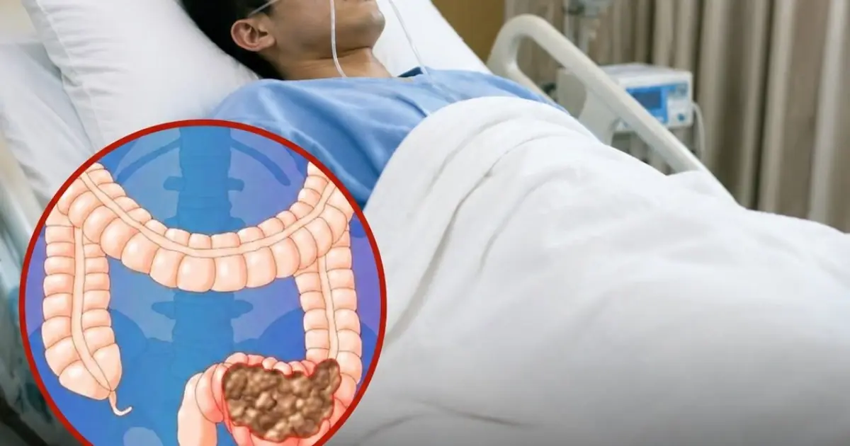 One warning sign. Age 25. Stage 3 colon c.ance.r. Don't ignore what your body is telling you.