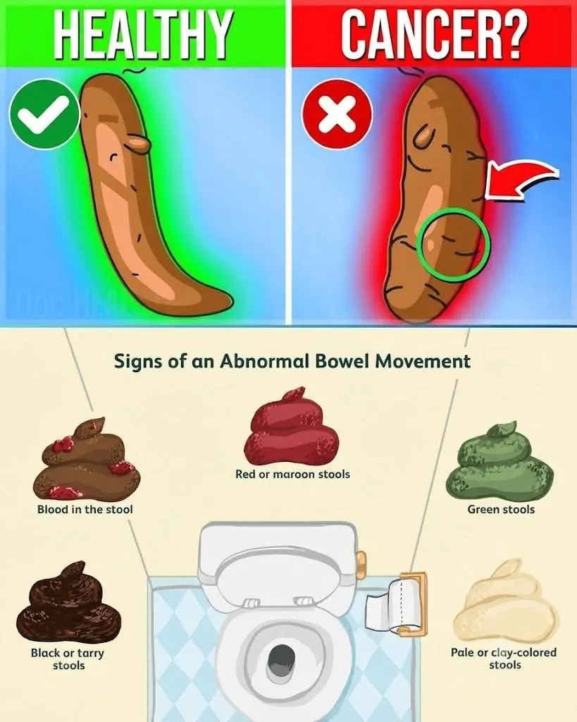 Stool Color Changes: What They May Mean for Your Health